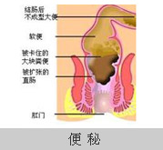 便密